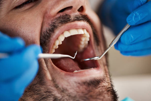 Best Orthodontic Emergency Dentist in Randolph Af, TX